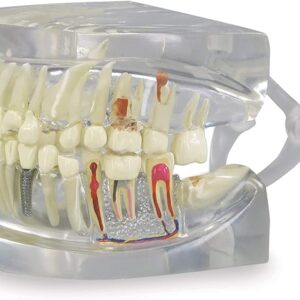 Transparent Dental Jaw Model